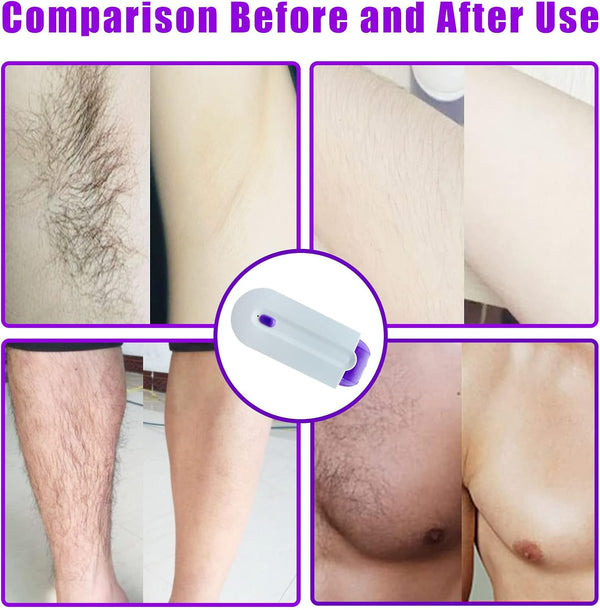 Epilator laser fara durere